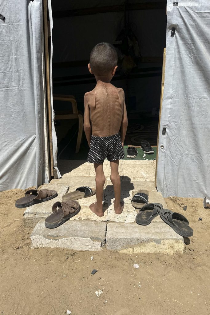 El niño gazatí Osama al Raqab, de 5 años, el 21 de abril de 2025. Como él, decenas de miles de niños en Gaza padecen malnutrición, debido a que Israel no permite la entrada de suministros. EFE/ Ahmad Awad